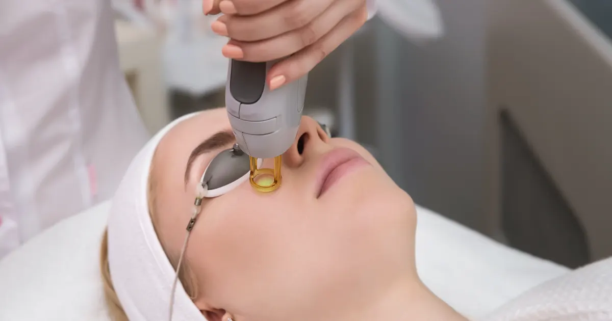 Skin-Laser-Treatment-Price-in-Pakistan